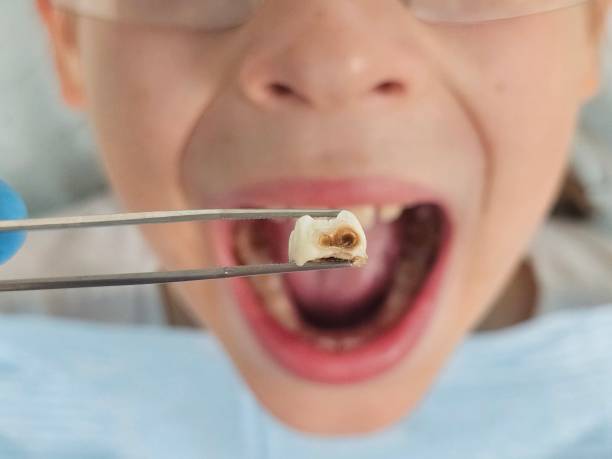 Best Emergency Treatment for Toothache in Shamrock, TX